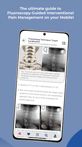 Interventional Pain App 螢幕截圖 3