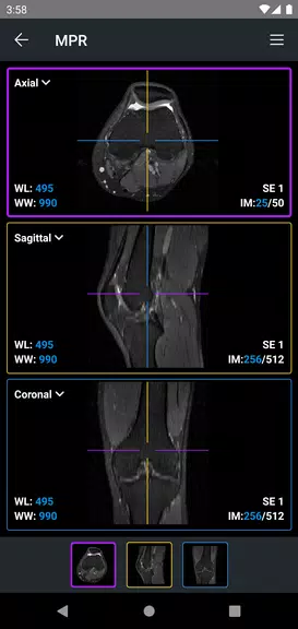 IDV - IMAIOS DICOM Viewer Скриншот 3